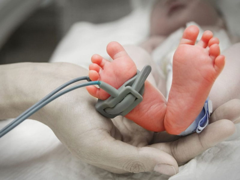 A prematuridade extrema é uma das principais causas de morte em recém-nascidos no país